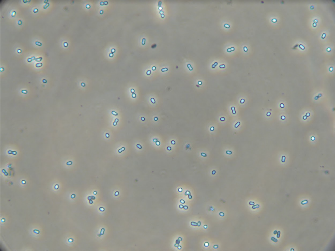 Image of &lsquo;Hot Peanuts&rsquo; under 400X magnification before S-layer removal. It phases bright because of the reflection of light off of the S-layer.