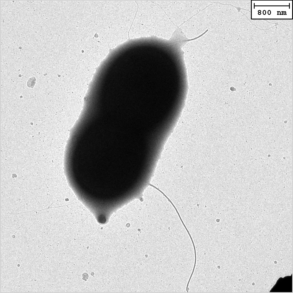 A close-up TEM image of a &lsquo;Hot Peanut&rsquo;