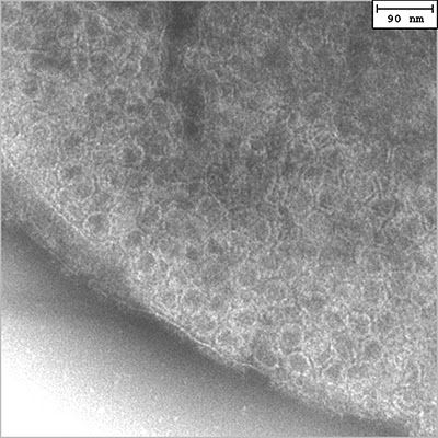 400x400 pixel TEM image of the S-layer pattern on the surface of a &lsquo;Hot Peanut&rsquo;.